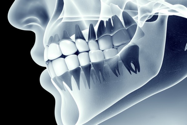 cirugia dental