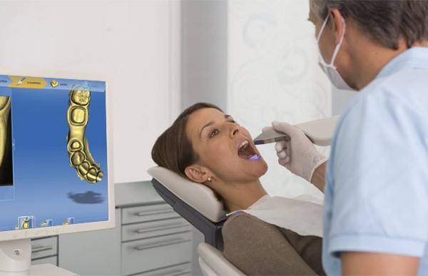 CAD-CAM Dental