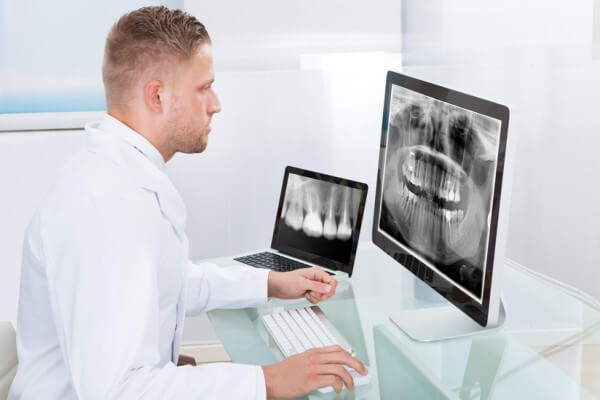 Radiovisiografia Dental